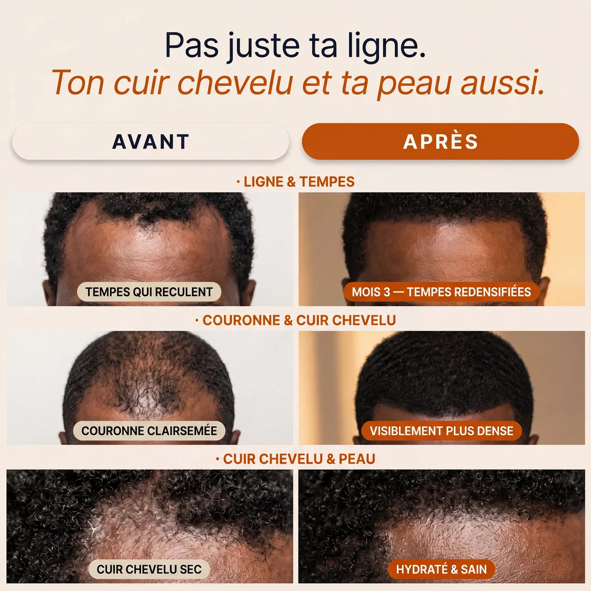 Gélules de Pépins de Courge — Anti-Chute Oren