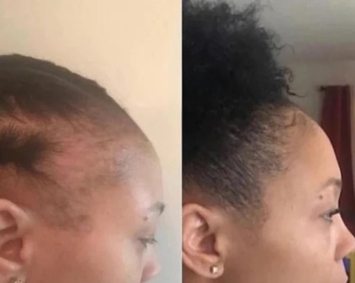 Before and after