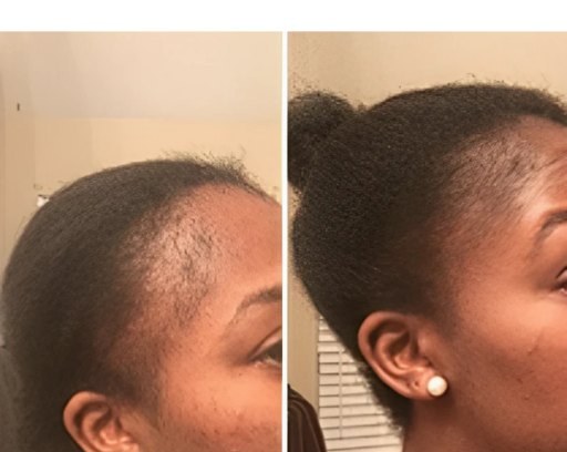 Before and after