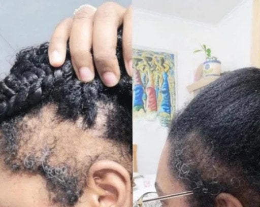 Before and after