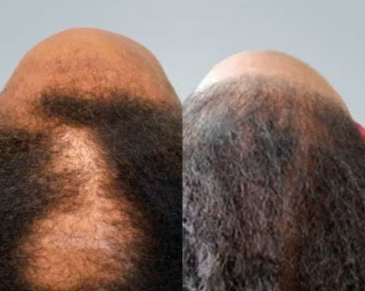 Before and after